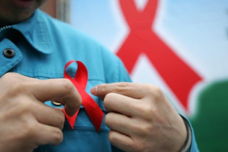 Nova variante do HIV está circulando em pelo menos três estados brasileiros, diz estudo