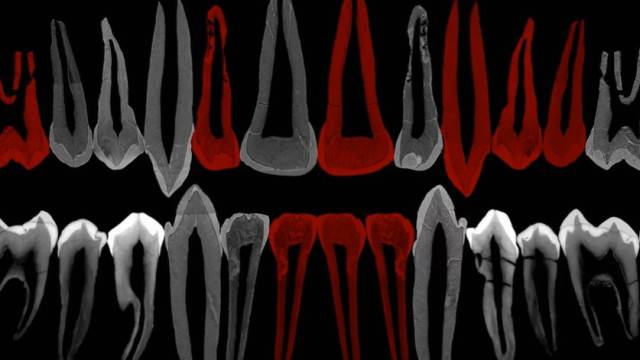 Dentes de adolescente de 1,8 milhão de anos mostram pistas de evolução do crescimento humano